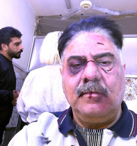 (غسان العزاوي): (العوالي) يقدمني في صورة جديدة، وأحببت الظهور في (بيت أم ليله)